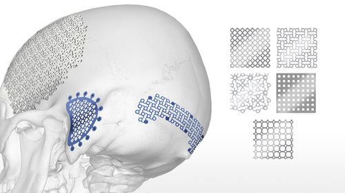 颅内植入物 - OsteoForm ™ - Acumed