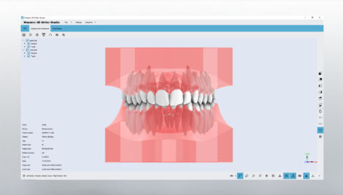CAD软件 - Studio - AGE Solutions - 3D 可视化 / 正畸 / 牙科实验室