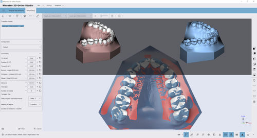 分析软件 - Ortho Studio - AGE Solutions - 3D 可视化 / 测量 / 加工