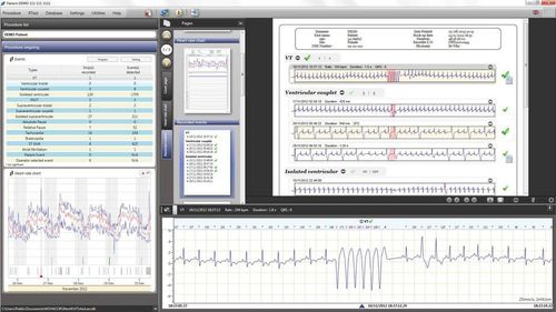 医学报告软件 - RTSoft Ultima - Novacor - 安全防护型 / 临床