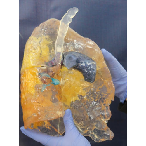肺部解剖模型 - ZJY-CVD-70 - Educational + Scientific Products Ltd - COVID-19新冠病毒 / 黄色