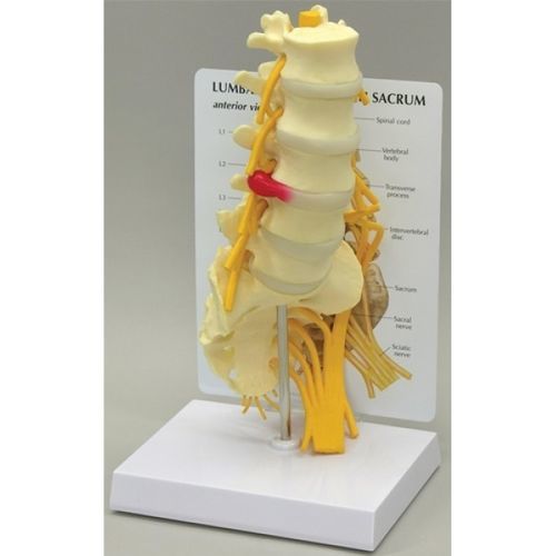 腰椎解剖模型- GBM-036 - Educational + Scientific Products Ltd