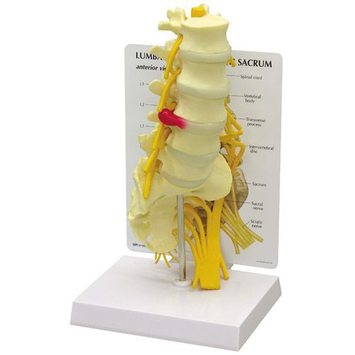 腰椎解剖模型 - 1700 - GPI Anatomicals - 教学