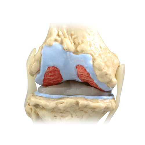 关节解剖模型 - 1100 - GPI Anatomicals - 膝盖 / 教学