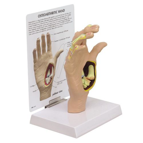 骨骼解剖模型 - 1930 - GPI Anatomicals - 关节 / 手 / 教学