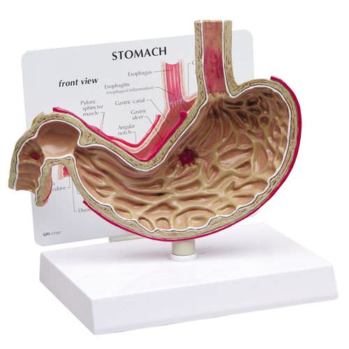 胃部解剖模型 - 2000 - GPI Anatomicals - 十二指肠 / 食道 / 教学