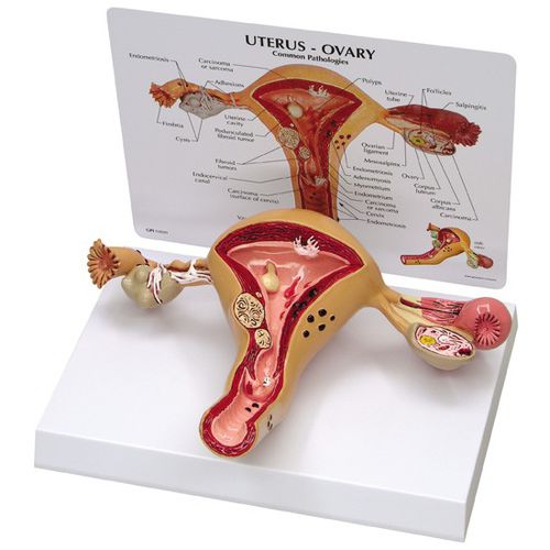 子宫解剖模型 - 3480 - GPI Anatomicals - 卵巢 / 教学 / 女性