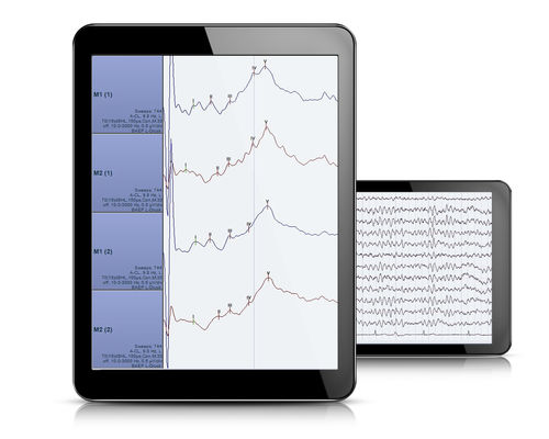 脑电图用软件 - AlphaView - Dr. Grossegger & Drbal alpha trace medical systems - 用于多导睡眠监测仪 / 分析 / Windows