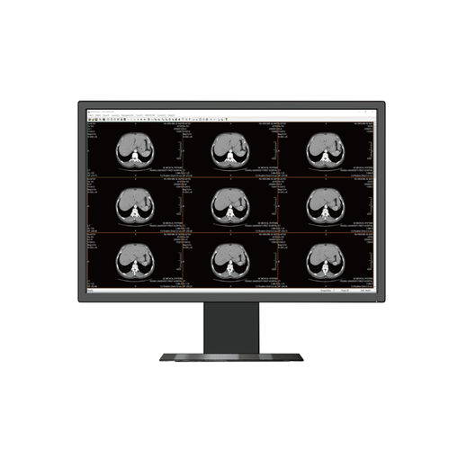 医用显示器 - HL2316SHA - Shenzhen Beacon Display Technology - 高解析度 / 23.8" / LED
