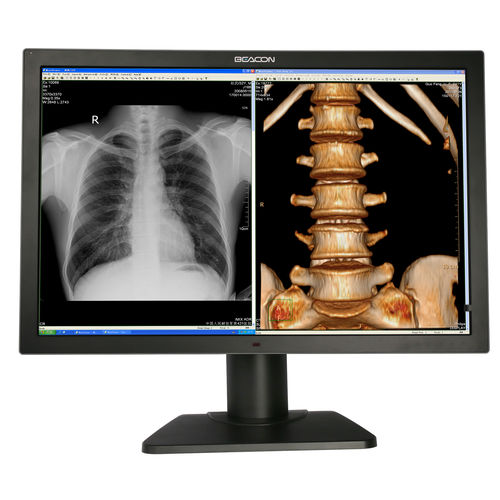 医用显示器 - C82W+ - Shenzhen Beacon Display Technology - 诊断 / 全高清Full HD / 3840 × 2160