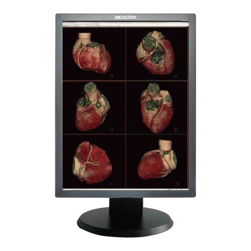 医用显示器 - C24S+ - Shenzhen Beacon Display Technology - 医学成像 / 诊断 / 高解析度