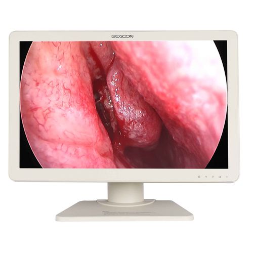 医用显示器 - E2421 - Shenzhen Beacon Display Technology - 手术室 / 内窥镜 / 全高清Full HD