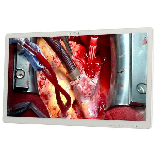 医用显示器 - S271P - Shenzhen Beacon Display Technology - 手术 / 1920 x 1080 / 27"