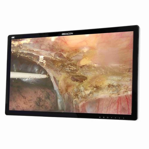 医用显示器 - S2785P - Shenzhen Beacon Display Technology - 手术 / 4K分辨率 / 27"