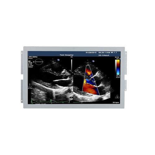 医用显示器 - U238W - Shenzhen Beacon Display Technology - 超声波成像 / 1920 x 1080 / 23.8"