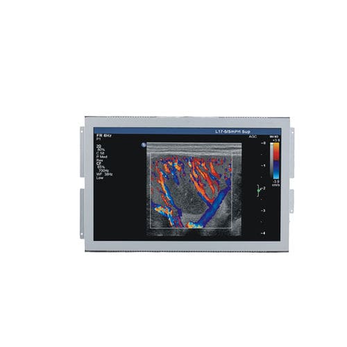 医用显示器 - U156W - Shenzhen Beacon Display Technology - 超声波成像 / 1920 x 1080 / 15.6"