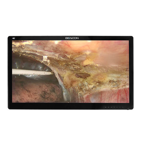医用显示器 - S3282P - Shenzhen Beacon Display Technology - 手术室 / 手术 / 4K分辨率