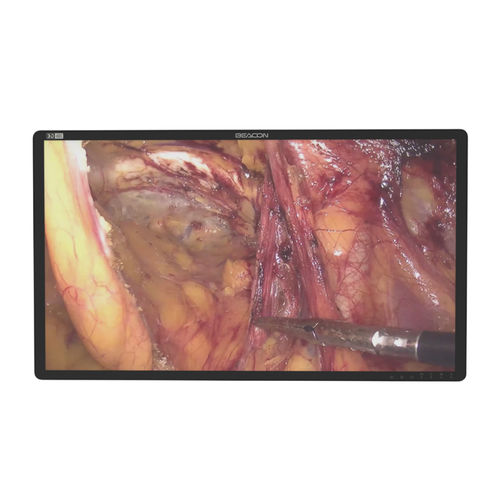 医用显示器 - S3285P-3D - Shenzhen Beacon Display Technology - 手术室 / 内窥镜 / 手术
