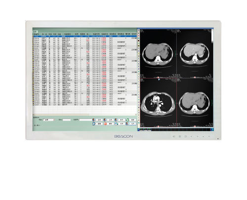 医用显示器 - HL2416SHT - Shenzhen Beacon Display Technology - 高解析度 / 24" / LED