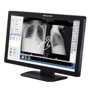 医用显示器 - C22WT - Shenzhen Beacon Display Technology - 高解析度 / 21.5" / LED
