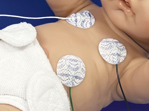 儿科ECG电极 - NeoLead® - Neotech Products