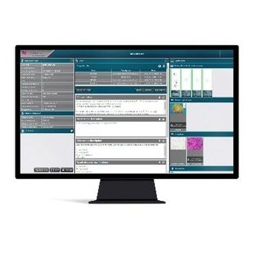 组织病理实验室信息系统 - CaseManager DX - 3DHISTECH Ltd. - 管理