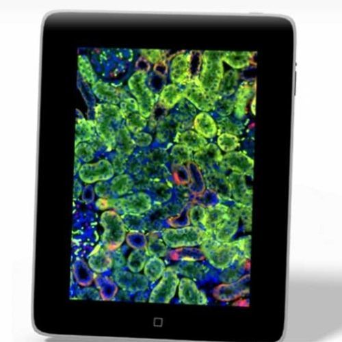 组织病理实验室iOS应用程序 - iPad Viewer - 3DHISTECH Ltd. - 用于虚拟显微镜检查 / 查看 / 培训