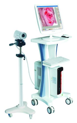 视频阴道镜 - LEO-2100I  - Xuzhou Leo Medical Equipments - 推车式