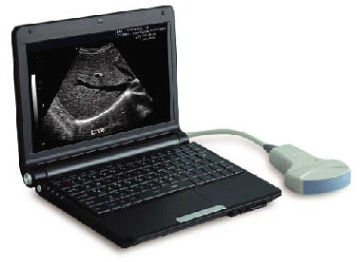 便携式B超机 -  LEO-3000D1  - Xuzhou Leo Medical Equipments - 用于多功能超声检查 / 黑白