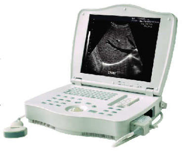 便携式B超机 - LEO-3000E1  - Xuzhou Leo Medical Equipments - 用于多功能超声检查 / 黑白 / 内置控制台