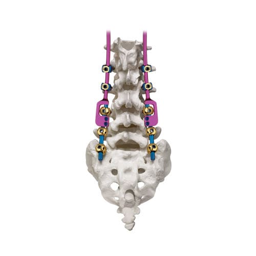 胸腰骶椎脊柱内固定系统 - REVERE® ADDITION® - Globus Medical - 后入路