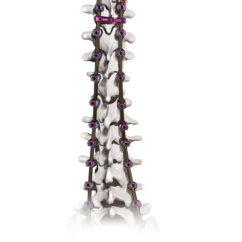 胸腰骶椎脊柱内固定系统 - CREO AMP® - Globus Medical - 后入路