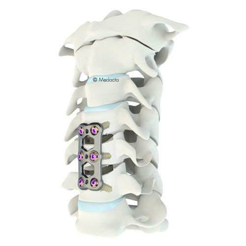 颈椎关节固定板 - Mecta®-C  - Medacta - 锁定 / 金属