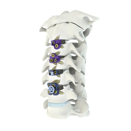 颈椎间融合器 - Mecta-C  - Medacta - 前入路 / 钛