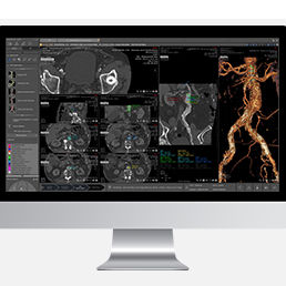 医用软件模块 - Myrian® XP-Vessel - Intrasense - 分析 / 可视化 / 规划