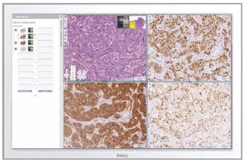 医学成像PACS系统 - Aperio eSlide Manager - Leica Biosystems - 用于医院 / 医用 / 临床