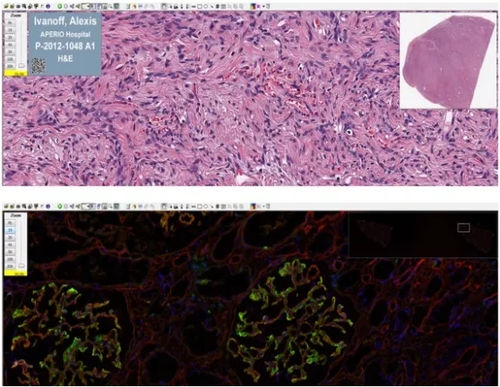 医用软件 - Aperio ImageScope - Leica Biosystems - 用于组织病理实验室 / 图像分析
