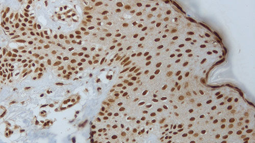 介质试剂试剂 - akt-phosphorylated - Leica Biosystems/徕卡显微镜系统 - 用于免疫组织化学 / 液体 / 抗原