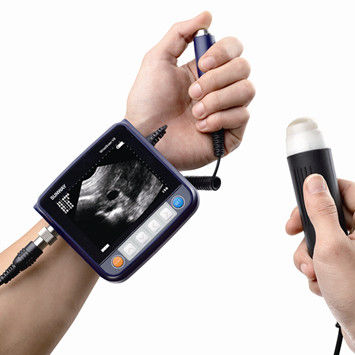 兽医超声波检查仪 / 手持式 - Wristscan V9 - Sunway Medical - 多功能 / 猪用