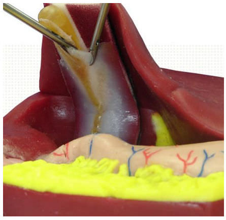 胆囊解剖模型 Lc 10 Simulab Corporation 胆囊切除术