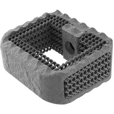颈椎间融合器 - NEXXT MATRIXX® - Nexxt Spine - 前入路 / 钛