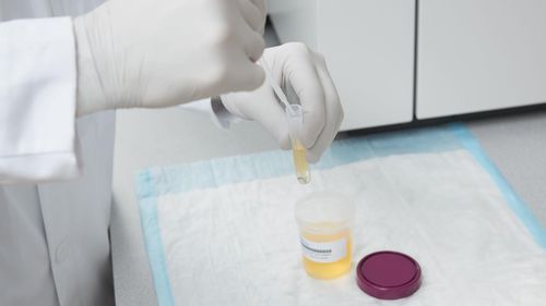 芬太尼快速诊断套装 - ARK™  - Siemens Healthineers - Laboratory Diagnostics/西门子医疗诊断 - 药物滥用 / 尿液
