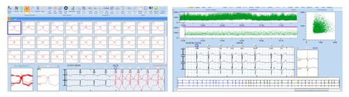 分析软件 - CardioTrak  - Beneware Medical Equipment - 动态心电图仪 / 医用