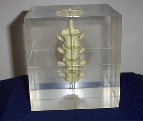 放射造影测试体模 - RS-1400 - Radiology Support Devices - 脊柱