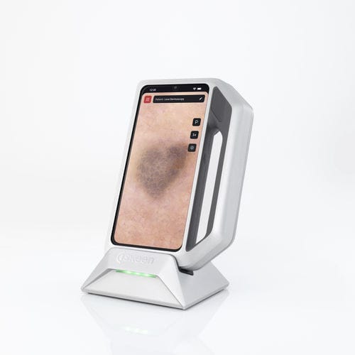 视频电子皮镜 - FotoFinder Systems - 白色LED