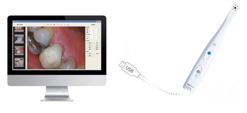 口腔内摄像机 - SuperVista-----HDI-210 - Handy Technologies - 数字 / CMOS / USB