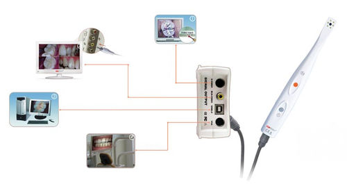口腔内摄像机 - CamAssist-----HDI-300/400A - Handy Technologies - 数字 / CCD