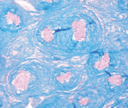 染色液试剂 - Enzymatic digestion hyaluronidase   - BIO-OPTICA Milano/意大利BIO-OPTICA - 用于组织学 / 用于细胞学