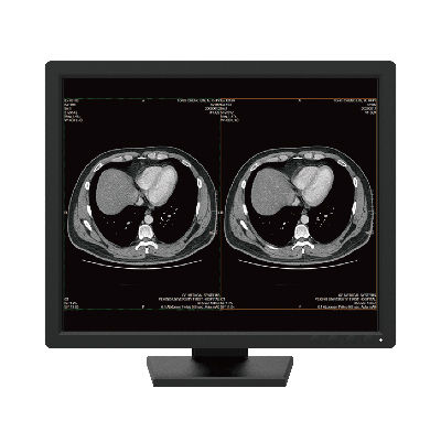 医用显示器 - R191 - Nanjing Jusha Display Technology - 诊断 / 1280 x 1024 / 19"