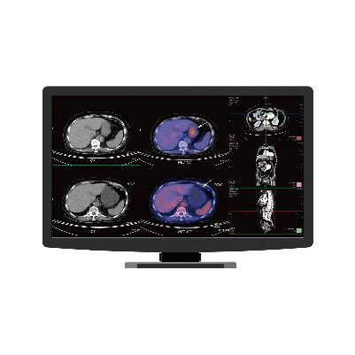 医用显示器 - CR22 - Nanjing Jusha Display Technology - 乳腺造影 / 高解析度 / 21.5"